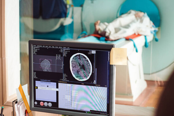 MRI machine and screens with doctor and nurse