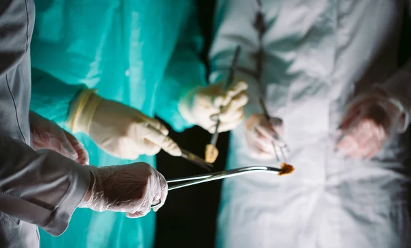 Nahaufnahme von Chirurgen, die medizinische Instrumente in der Hand halten. der Chirurg führt eine Operation durch — Stockfoto