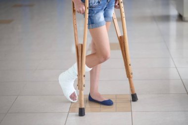 A young girl is on crutches in the corridor of the hospital clipart