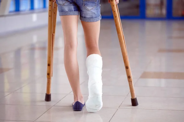 Uma jovem está de muletas no corredor do hospital. — Fotografia de Stock