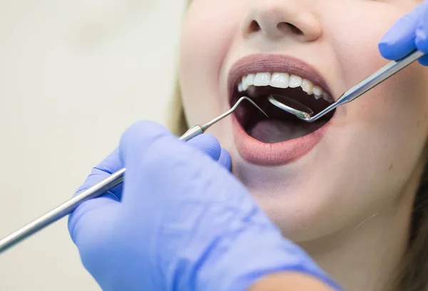 Imagen de cerca de una joven sentada en la silla del dentista con la boca abierta en el consultorio del dentista mientras se somete a examen — Foto de Stock