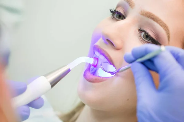 Dentista haciendo procedimiento con la luz UV de curado dental en la clínica. — Foto de Stock