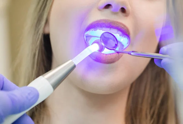 Dentista haciendo procedimiento con la luz UV de curado dental en la clínica — Foto de Stock