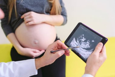 Jinekolog hamile kadına yankı fotoğrafı gösteriyor