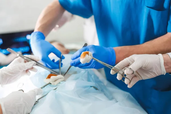 Detailaufnahme einer Operation. Gruppe von Chirurgen bei der Arbeit im Operationssaal. — Stockfoto