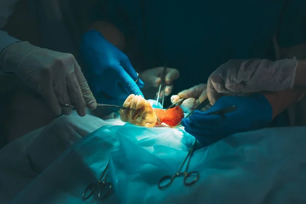 Close up detail of a surgery. Group of surgeons at work operating in surgical theatre. — Stock Photo, Image