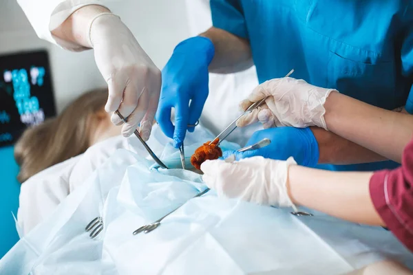 Detailaufnahme einer Operation. Gruppe von Chirurgen bei der Arbeit im Operationssaal. — Stockfoto