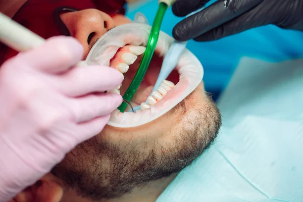 Professional teeth cleaning. Dentist cleans the teeth of a male patient. — Stock Photo, Image