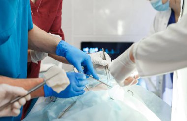 Cerrahi tiyatroda çalışan bir grup cerrah. Kurtarma ekibi koruyucu maskeler takıyor çelik tıbbi aletler tutuyor hastayı kurtarıyor. Ameliyat ve acil durum konsepti.