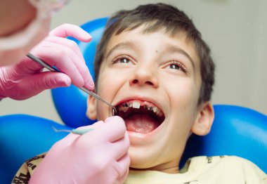 Diş hekimindeki genç hasta. Dişleri sorunlu bir çocuk dişçi koltuğunda oturuyor..