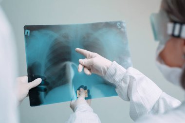 Beyaz arka planda duran doktorlar klinikteki Covid-19 hastasının zatürresi için röntgen çekiyorlar. Coronavirus konsepti.