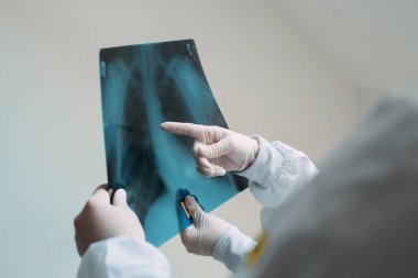 Beyaz arka planda duran doktorlar klinikteki Covid-19 hastasının zatürresi için röntgen çekiyorlar. Coronavirus konsepti.