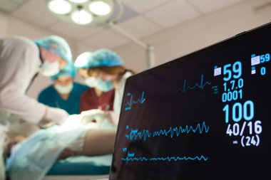 Ameliyathanedeki hastada EKG ve oksijen doygunluğu gözlemleniyor..