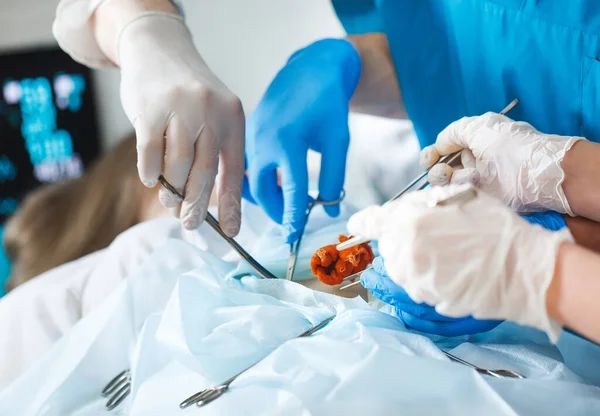 Detailaufnahme einer Operation. Gruppe von Chirurgen bei der Arbeit im Operationssaal. — Stockfoto