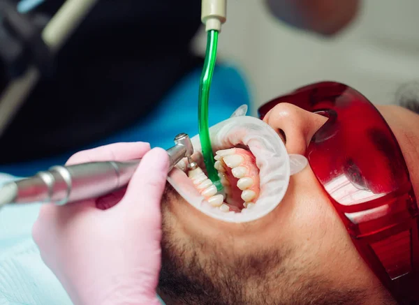 Profesjonalne czyszczenie zębów. Dentysta myje zęby męskiemu pacjentowi. — Zdjęcie stockowe