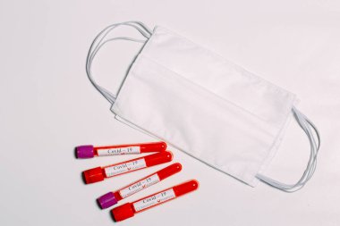 Coronavirus aşısı. Test tüplerinde Coronavirus için pozitif kan testleri.