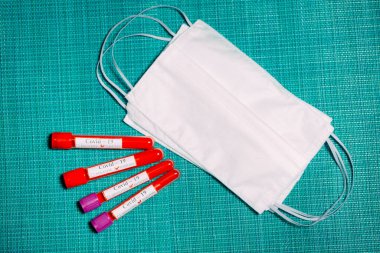 Coronavirus aşısı. Test tüplerinde Coronavirus için pozitif kan testleri.