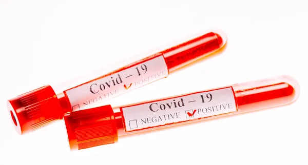 시험관에서의 코로나 바이러스 양성 혈액 검사. — 스톡 사진