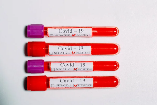 시험관에서의 코로나 바이러스 양성 혈액 검사. — 스톡 사진