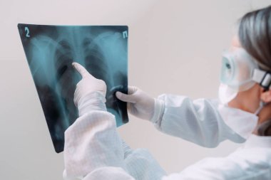 Beyaz arka planda duran doktorlar klinikteki Covid-19 hastasının zatürresi için röntgen çekiyorlar. Coronavirus konsepti.