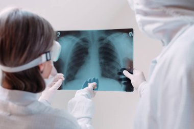 Beyaz arka planda duran doktorlar klinikteki Covid-19 hastasının zatürresi için röntgen çekiyorlar. Coronavirus konsepti.