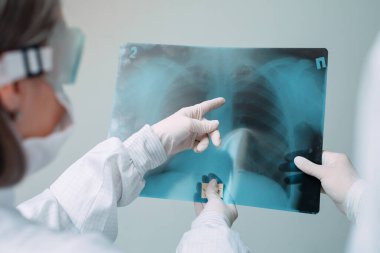 Beyaz arka planda duran doktorlar klinikteki Covid-19 hastasının zatürresi için röntgen çekiyorlar. Coronavirus konsepti.