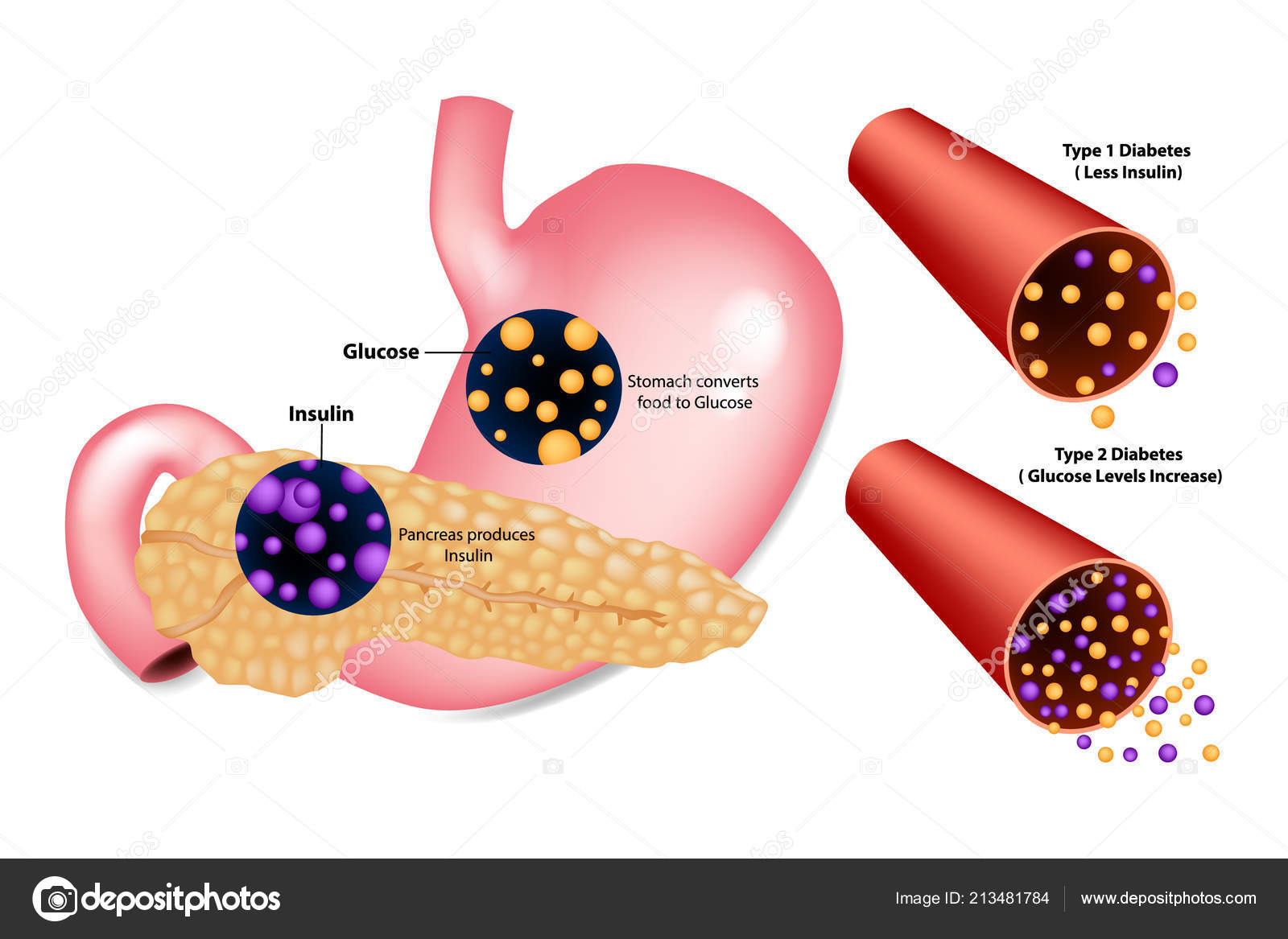 Glucosa insulina y diabetes