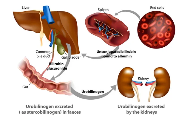 Bilirrubina Metabolismo Ilustración Médica — Vector de stock