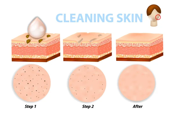 顔のスキンケア 毛穴洗浄します 皮膚の洗浄の手順 ボディス クラブ 洗浄剤 保湿剤の使用後 — ストックベクタ