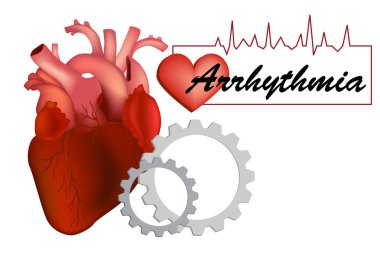 Heart arrhythmia (also known as arrhythmia, dysrhythmia, or irregular heartbeat). clipart