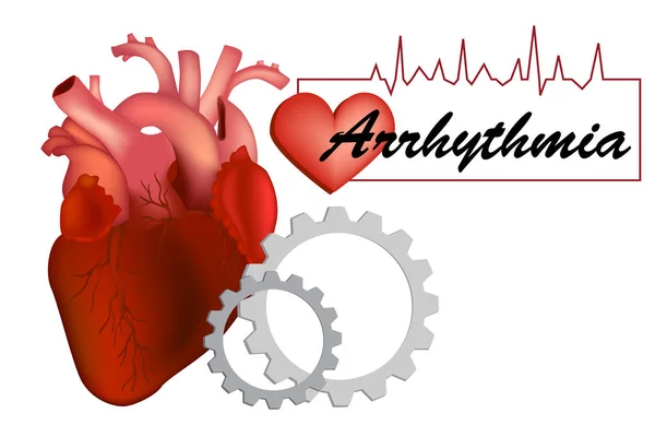 Kalp Ritim Bozukluğu Olarak Bilinen Aritmi Dysrhythmia Veya Düzensiz Kalp — Stok Vektör