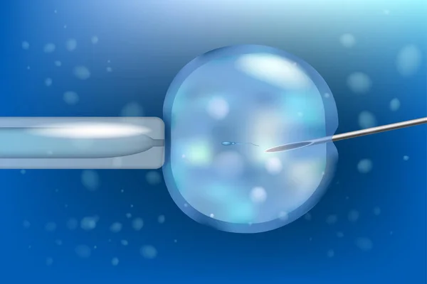 Inseminación Artificial Fecundación Vitro Fiv Macro Tubo Ensayo Bebé — Vector de stock