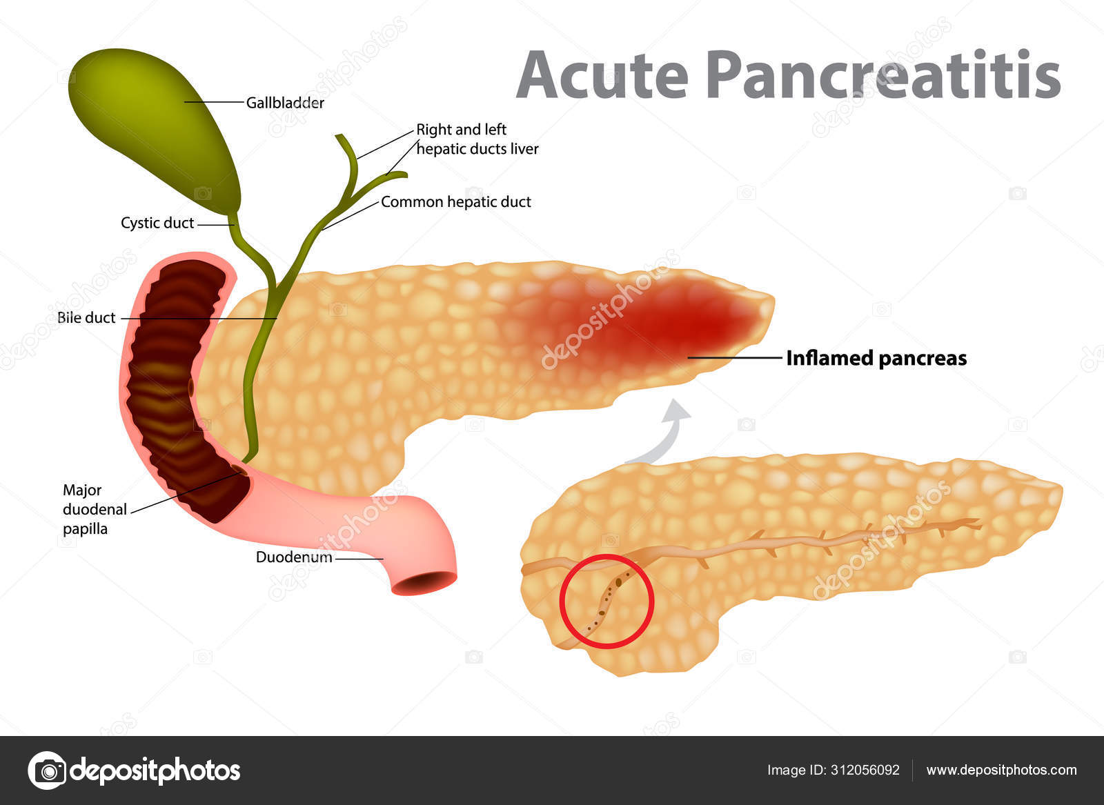 pancreatic juices pancreatic juices