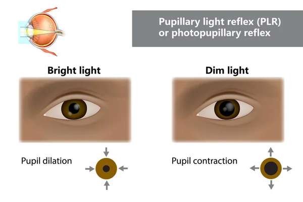 Odruch Źrenicy Plr Lub Odruch Fotopupillarny Jak Uczniowie Zmieniają Rozmiar — Wektor stockowy