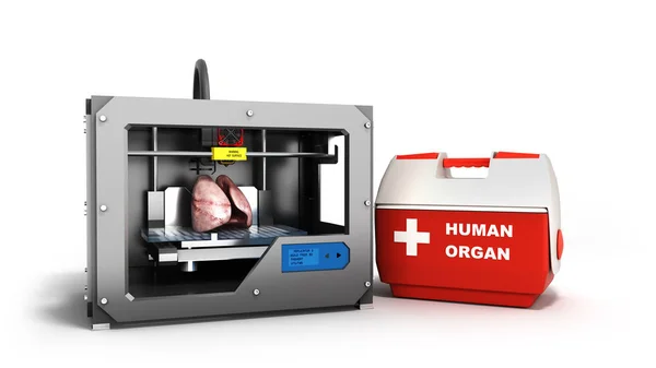 Conceito Processo Transplante Órgãos Humanos Usando Ilustração Impressora Isolada Branco — Fotografia de Stock