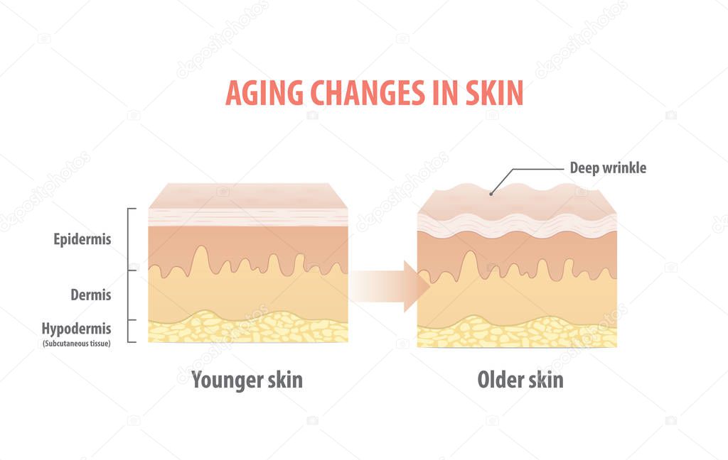 Aging changes in skin illustration vector on white background. Beauty concept.
