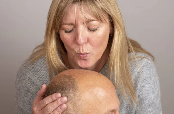 Mujer Besando Cabeza Calva Hombre —  Fotos de Stock