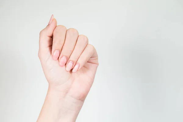 Primer Plano Mano Blanca Femenina Con Manicura Pulida Gel Viejo — Foto de Stock