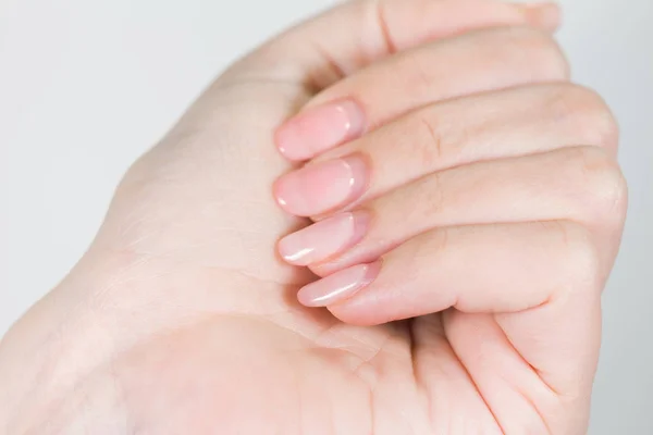 Closeup Θηλυκό Λευκό Χέρι Παλαιό Gel Γυαλισμένο Μανικιούρ Χρειάζονται Διόρθωση — Φωτογραφία Αρχείου