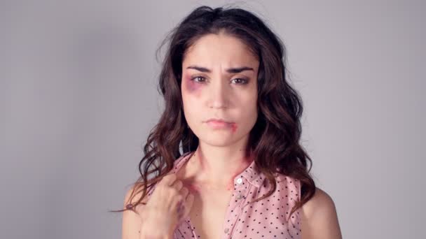 Σταματήσει την ενδοοικογενειακή βία και κακοποίηση. Γυναίκα με εκδορές και ξυλοδαρμούς με ένα ανοικτό χέρι με το stop λέξεις — Αρχείο Βίντεο