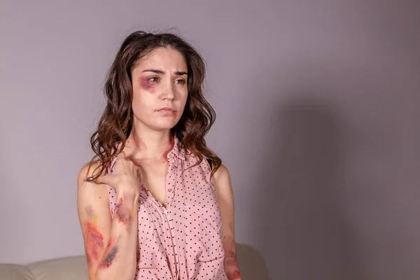 Violencia - Mujer víctima de violencia doméstica y abuso sobre fondo gris — Foto de Stock