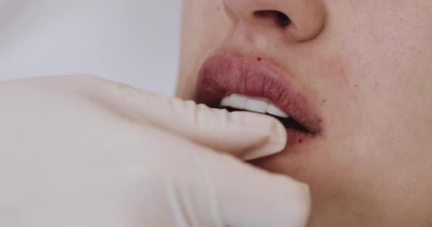 Aumento de labios, de cerca. El médico cosmetólogo hace el procedimiento del aumento de labios de la mujer hermosa en el salón de belleza. Concepto cosmético de inyección de belleza — Vídeos de Stock