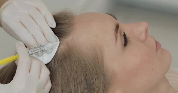 Młoda atrakcyjna kobieta otrzymuje mezoterapię za włosy. Dziewczyna otrzymuje zastrzyk w głowę. Zamknij się.. — Wideo stockowe