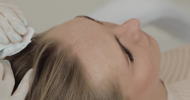 Ung attraktiv kvinna får mesoterapi för hår. Flickan får en injektion i huvudet. Närbild. — Stockvideo