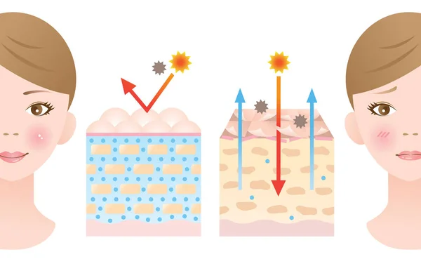 Normal Och Torr Hud Diagram Illustration Kvinnas Skönhet Och Hud — Stock vektor