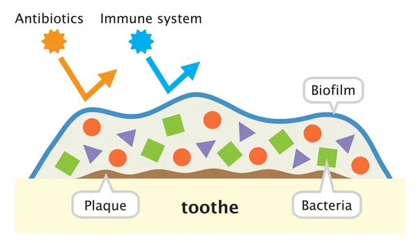 Biofilm Tand Illustration Tandvård Och Oral Vård Koncept — Stock vektor