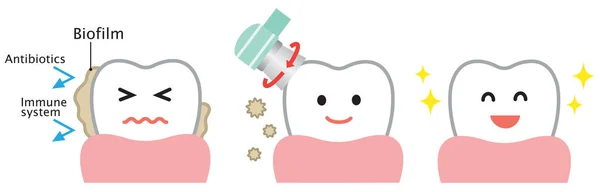dental biofilm removal cute cartoon illustration. dental health and oral care concept
