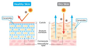 dry and healthy skin layer illustration. beauty and skin care concept clipart