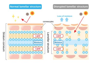 structure of stratum corneum and lamellar structure, which play the protective role for skin barrier functions. beauty and skin care concept clipart