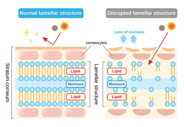 Estructura Estrato Córneo Estructura Lamelar Que Desempeñan Papel Protector Para — Vector de stock